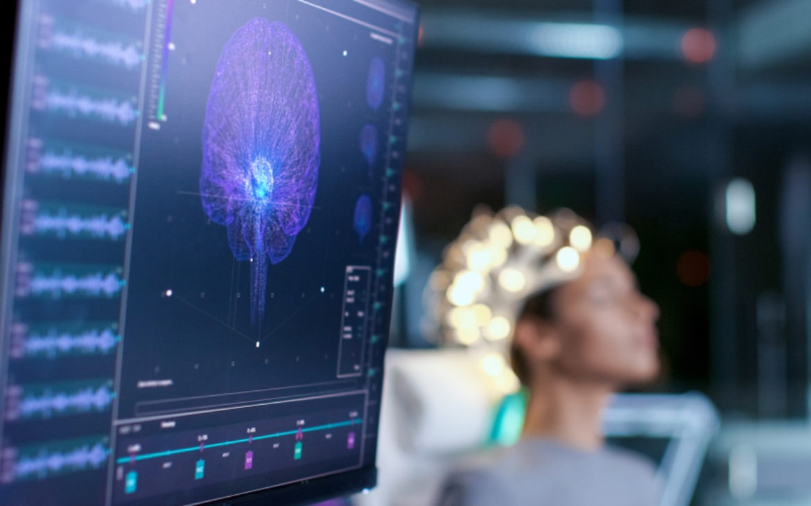 Tehnologija „čitanja misli” prevodi moždane valove u fotografije